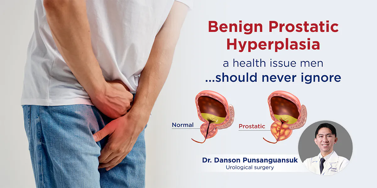 Benign Prostatic Hyperplasia…a health issue men should never ignore ...